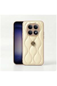 Related product image Zebana Phone Case