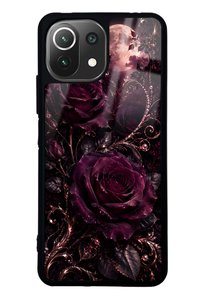 Related product image Spoyi Phone Case