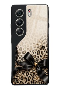 Related product image Spoyi Phone Case