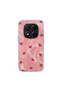 Related product image Zebana Phone Case