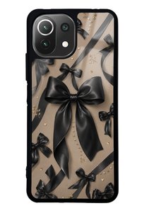 Related product image Spoyi Phone Case