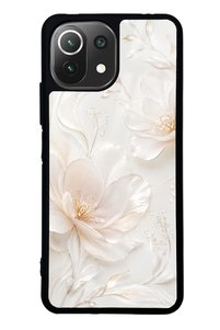Related product image Spoyi Phone Case