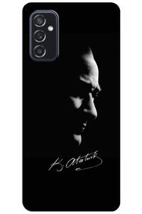 Related product image Zebana Phone Case