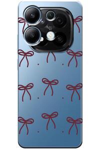 Related product image Zebana Phone Case