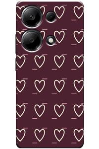 Related product image Zebana Phone Case