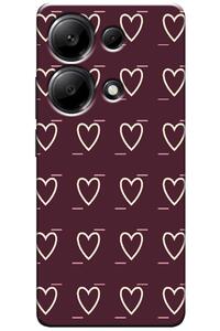 Related product image Zebana Phone Case