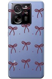 Related product image Zebana Phone Case