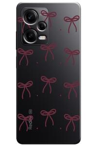 Related product image Zebana Phone Case