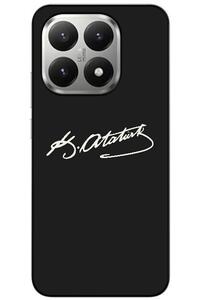 Related product image Zebana Phone Case