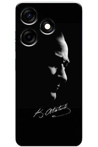Related product image Zebana Phone Case