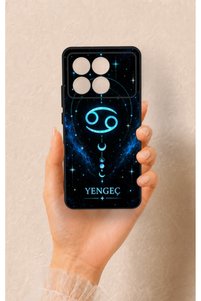 Related product image Vip Case Phone Case