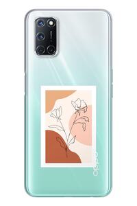 Related product image Spoyi Phone Case