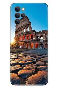 Related product image omix Phone Case