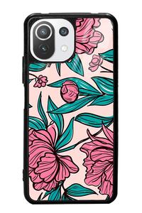 Related product image Spoyi Phone Case