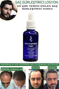 Saç Losyonu - Saç Gürleştirici - Saç Bakım - Hair Losyon / 3 Adet Roller ürün fotoğrafı