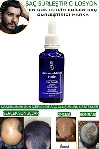 Saç Losyonu - Saç Gürleştirici - Saç Bakım - Hair Losyon / 3 Adet Roller ürün fotoğrafı