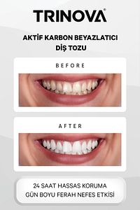 Diş Beyazlatıcı Toz Aktif Karbon Diş Temizleme Tozu ürün fotoğrafı