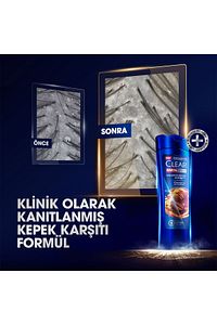 Men Kepeğe Karşı Etkili Şampuan Saç Dökülmesine Karşı 350 ml X3 ürün fotoğrafı