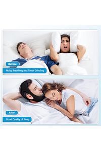 Horlama Bandı ve Ağız Çene Kapatma Önleyici Bant Maske Çene Destekli Horlama Bandı Aparatı ürün fotoğrafı