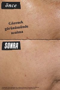 Siyah Nokta Karşıtı ve Gözenekleri Derinlemesine Arındıran Rare Earth Kil Maskesi 125 ml ürün fotoğrafı