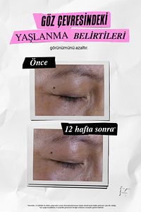 Super Multi Corrective Antiaging Göz Kremi - Kırışıklık & Koyu Halka Karşıtı Bakım 14 Ml ürün fotoğrafı