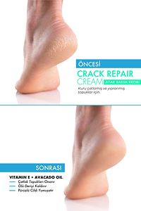 MRS.UMRANTOO Crack Repair Cream Ayak Bakım Kremi 100 ml ürün fotoğrafı
