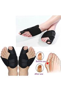 Medikal Ortopedik Halluks Valgus Gece Ayak Başparmak Ateli Ayak Başparmak Kemik Düzeltici ürün fotoğrafı