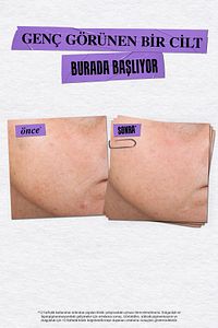 Dermatologist Solutions Retinol İçeren Kırışıklık Karşıtı Günlük Serum 30 ml ürün fotoğrafı