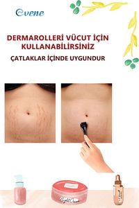 Dermaroller Saç Çıkarma Tarağı İğneli Tarak Saç Rulosu Roller 1 mm Saklama Kabı ürün fotoğrafı