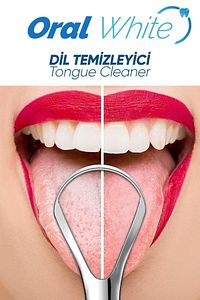 Paslanmaz Çelik Dil Temizleyici ve Dil Sıyırıcı 2 Parça ürün fotoğrafı
