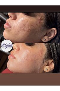Yosun Peeling Yüz Peelingi Cilt Bakımı Yosun Maskesi Cilt Soyucu Leke Akne Sivilce 5 Kullanımlık ürün fotoğrafı