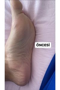 1 Çift Çorap Tipi Ölü Deri Ve Çatlaklar Için Soyulabilen Limon Aromalı Ayak Peeling Maskesi ürün fotoğrafı