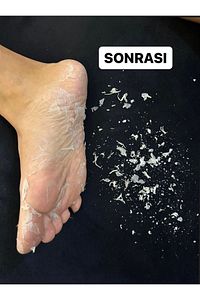 1 Çift Çorap Tipi Ölü Deri Ve Çatlaklar Için Soyulabilen Limon Aromalı Ayak Peeling Maskesi ürün fotoğrafı