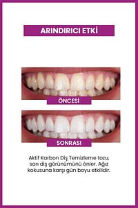 Aktif Karbonlu Diş Beyazlatıcı Toz | Sigara, Çay & Kahve Lekelerine Karşı | Doğal Formül | 50g ürün fotoğrafı