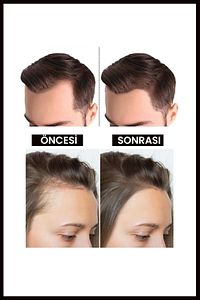 Kara Sarımsak Yağı | Aşırı Yıpranmış ve Dökülen Saçlara Bakım | Besleyici & Onarıcı Yağ | 50ml ürün fotoğrafı