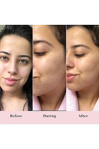 Peeling Jel Mekanik Soyucu - 200 ml ürün fotoğrafı