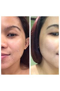 Peeling Jel Mekanik Soyucu - 200 ml ürün fotoğrafı