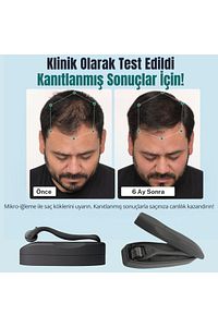 Titanyum Uçlu 540 İğneli Saç Sakal Çıkarma Ve Cilt Bakım Dermarolleri Masaj Aleti 1 mm ürün fotoğrafı
