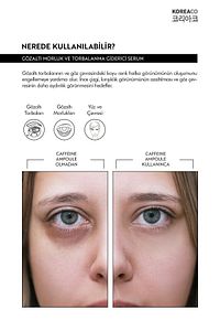 Caffeine Ampoule Gözaltı Torba & Koyu Halka Karşıtı ürün fotoğrafı