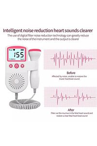 Fetal Doppler Jsl- T501 3 Mhz Hamile / Bebek Kalp Atışı Ölçme ürün fotoğrafı