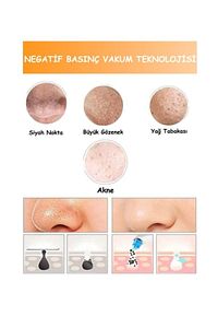 Vakumlu Pilli Siyah Nokta ve Yüz Temizleme Cihazı ürün fotoğrafı