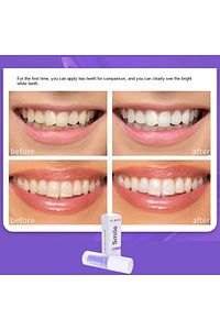 Smile Anında Diş Beyazlatma Jeli ürün fotoğrafı