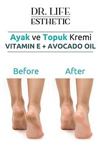 Çatlak Onarıcı Ayak ve Topuk Kremi Crack Repair Cream 100 ml ürün fotoğrafı