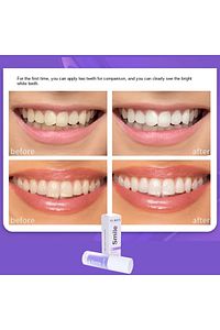 Diş Beyazlatıcı Jel 30 ml Smile V34 Colour Corrector ürün fotoğrafı