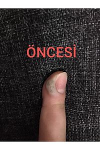 Nasırderm Nasır Sökücü ürün fotoğrafı
