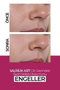 Nemlendirici Cilt Yenileyici Leke Karşıtı Krem 50ML ürün fotoğrafı