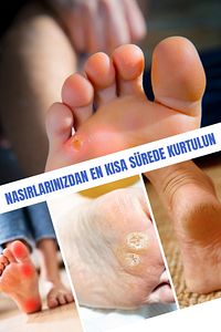 Nasır Seti ürün fotoğrafı