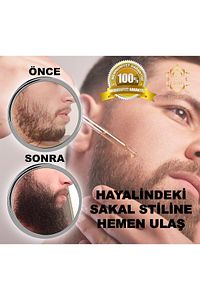Sakal Dolgunlaştırıcı Ve Canlandırıcı Bakım Serumu& Sakal Serumu&beard Oil&bıyık Serumu ürün fotoğrafı