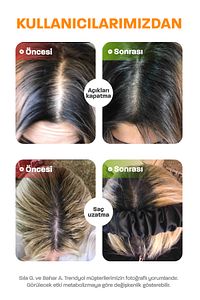 Saç ve Tırnak Vitamini - Hair Vitamin B Complex - Biotin Tablet Keratin Selenyum Çinko - Dökülmesine ürün fotoğrafı