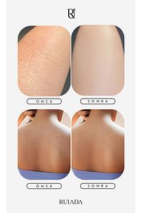 80 Factor Siyah Banyo Duş Kesesi Peeling Eldiveni %100 Floş Ipek Premium Unisex ürün fotoğrafı